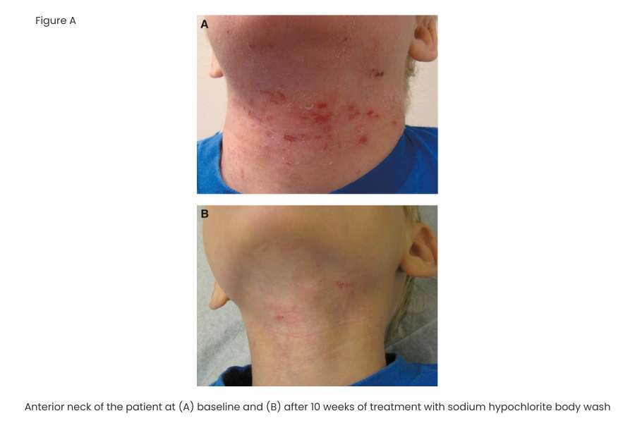 Figure A Cln bodywash results