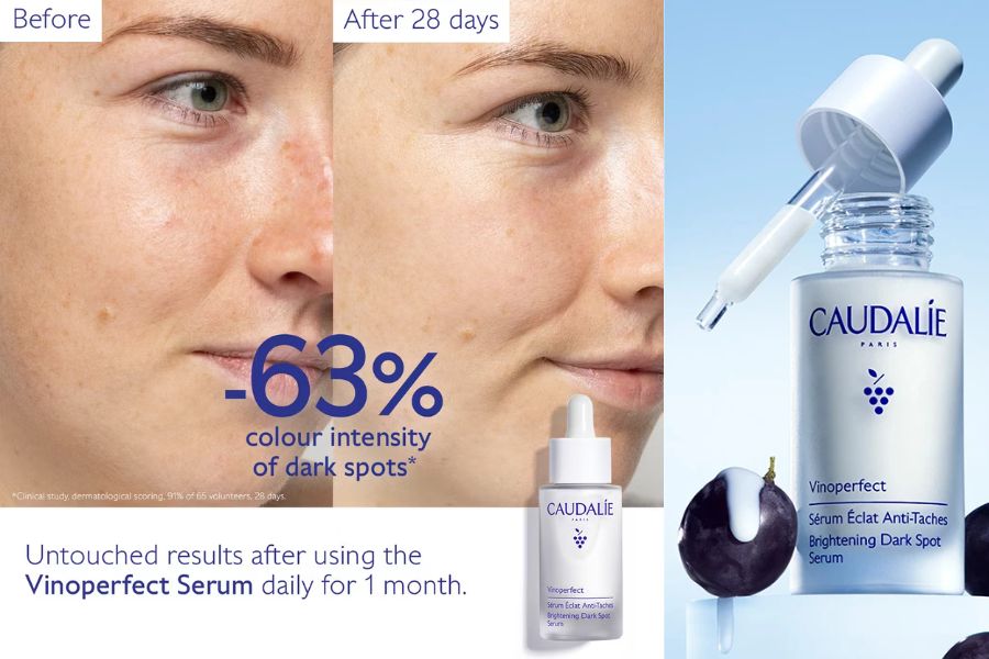 caudalie-vinoperfect-brightening-dark-spot-serum-before-and-after-28-days