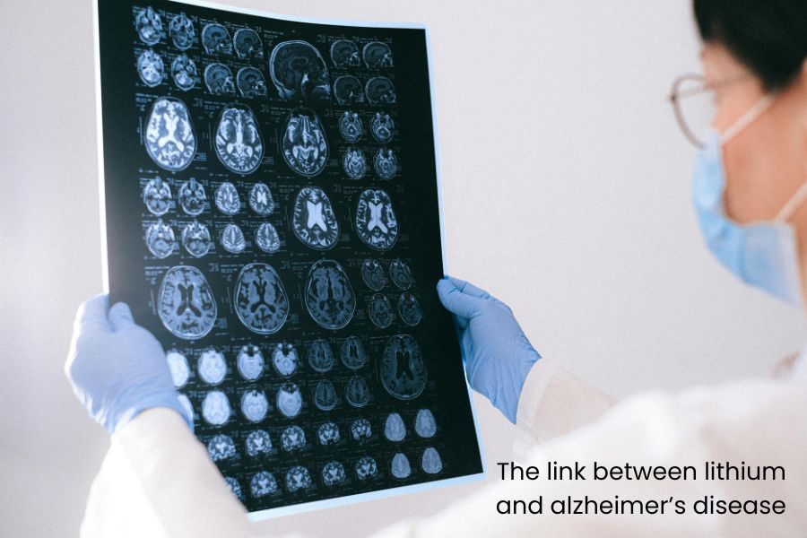 The link between lithium and alzheimerâs disease