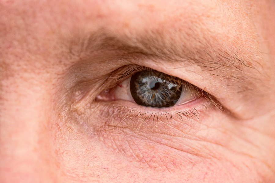 Can I Prevent Wrinkles On My Face?