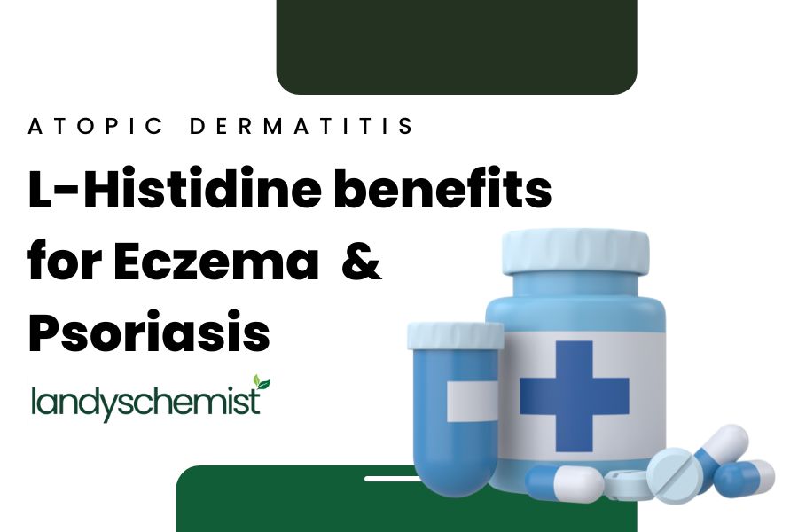 l-histidine benefits for eczema