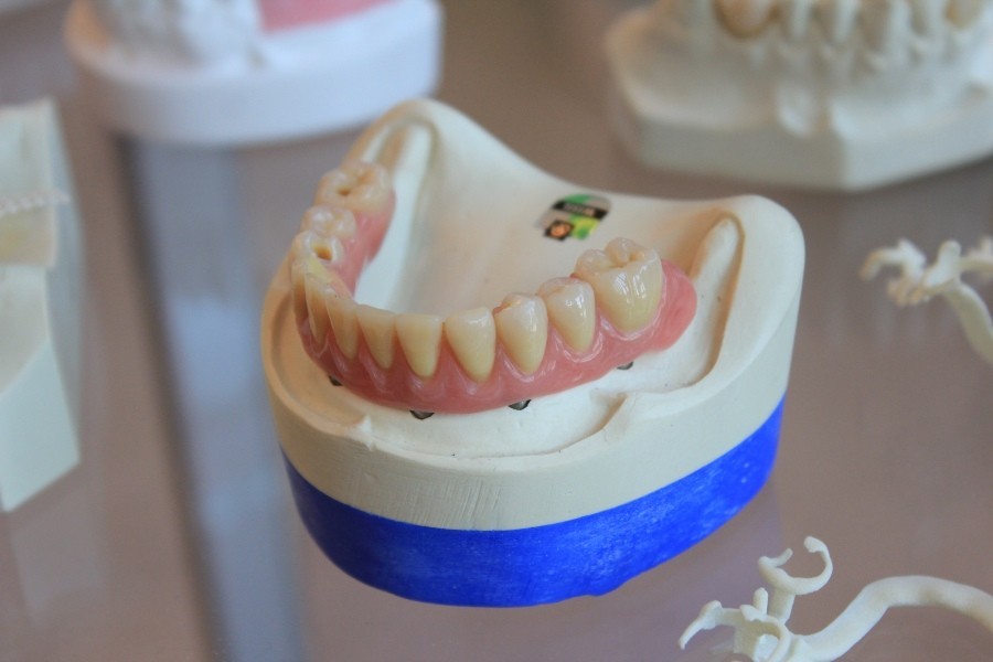 model of teeth model of teeth
